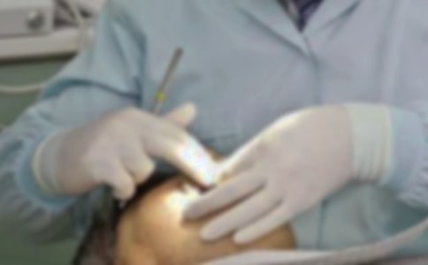 拔牙記作文集錦(15篇)