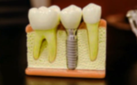 ���������ġ��R��15ƪ��