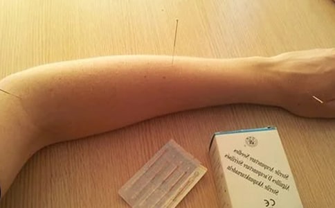 ᘾ�����Ѩλ����Щ