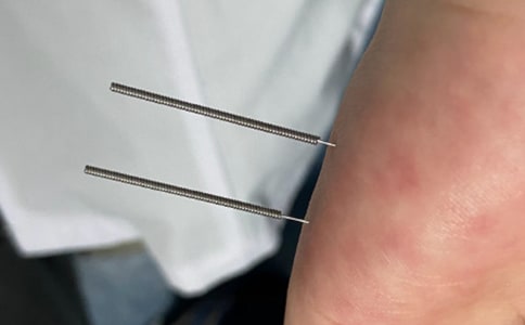 ����ᘾ�Ѩλ����Щ