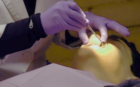 �oʹ΢��(chu��ng)���g�����M�������X�γ��g�е��R������