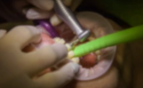 拔牙_寫(xiě)事作文250字_二年級(jí)寫(xiě)事作文