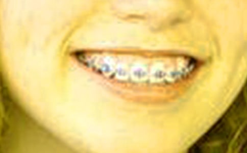 ȡ���׳��������ģ����x16ƪ��