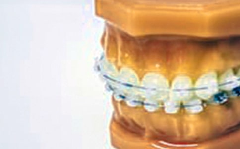 牙套讓我煩_550字