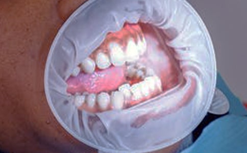 ˢ�����l��Ѫ��ô����