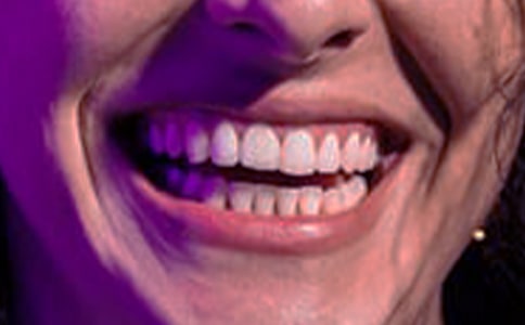 �ЋD���l��Ѫ��ô�k